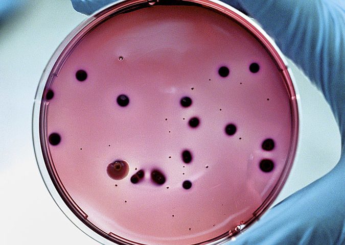 Petrischale für die mikrobiologische Lebensmitteluntersuchung
