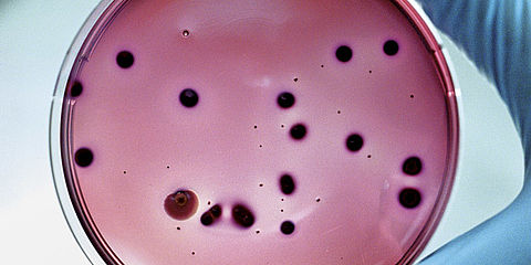 Petrischale für die mikrobiologische Lebensmitteluntersuchung